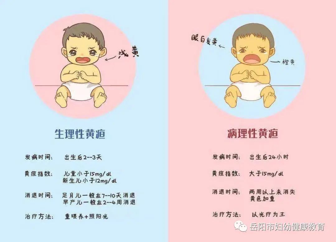 婴儿泪腺堵塞有哪些症状？ - 知乎