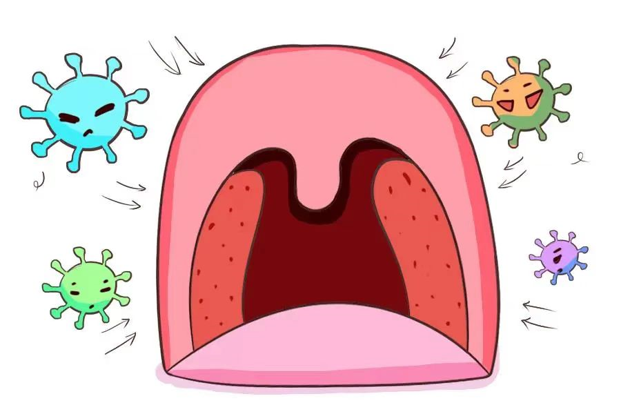 科普常识扁桃体经常性发炎怎么办