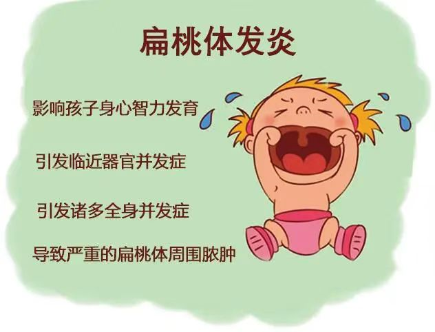 科普常识扁桃体经常性发炎怎么办