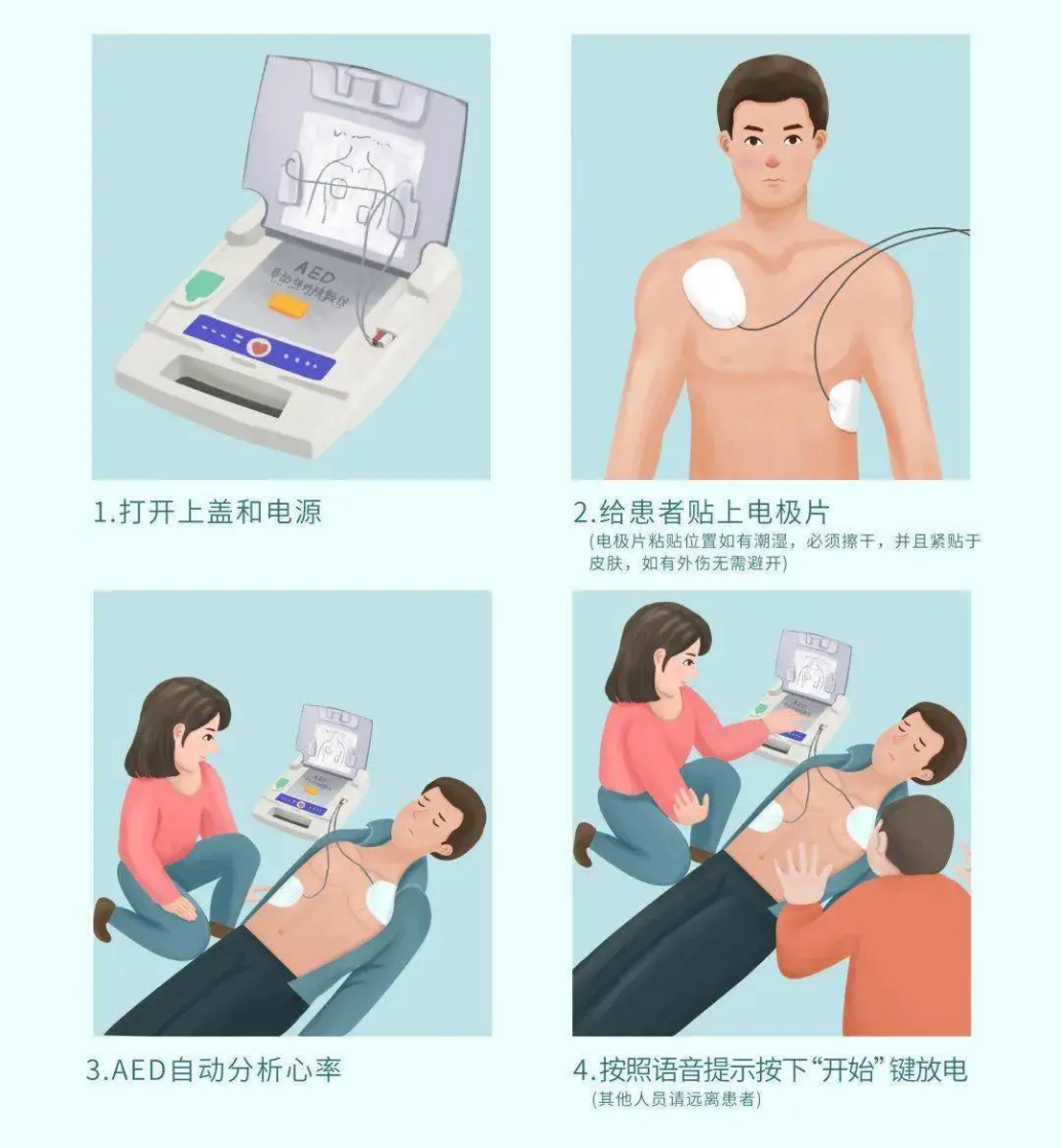 在黄金四分钟实施心肺复苏术,一起来学