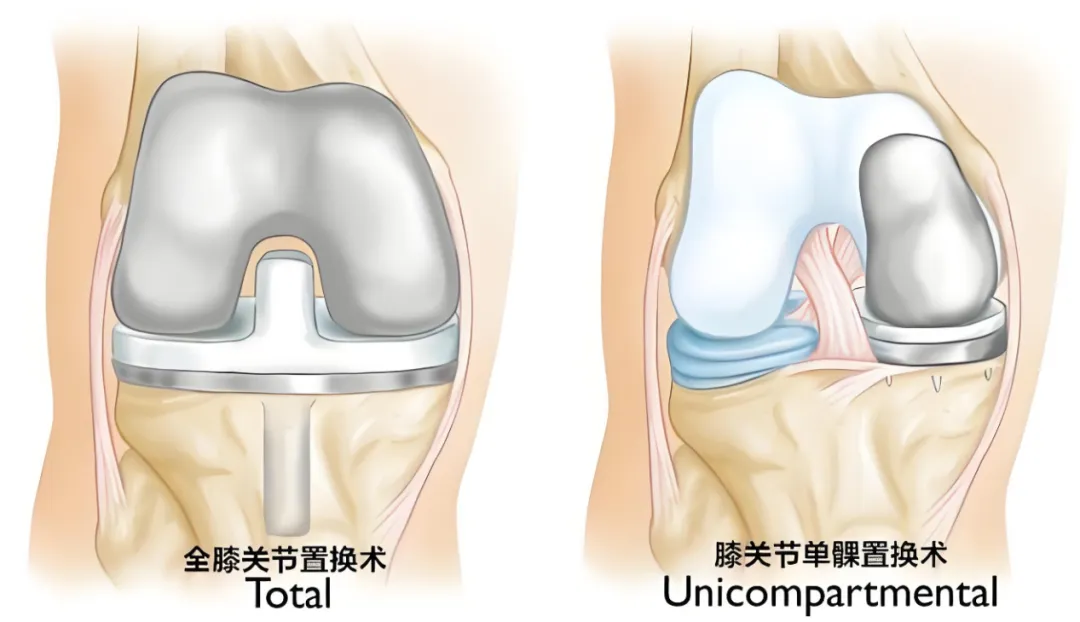 35262453b8d729356a337062ce5fc111-sz_630563_看图王.web.png