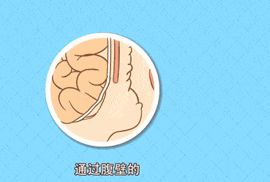 5caea663d85110b6a60674e8fbe2b389_640_wx_fmt=gif&from=appmsg&randomid=3i1n3kws.gif