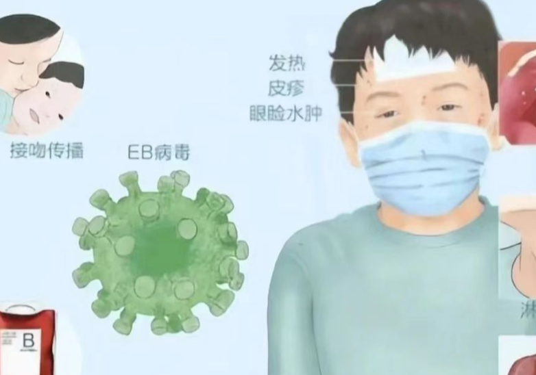 儿童易中招的 “亲吻病”：你想知道的都在这