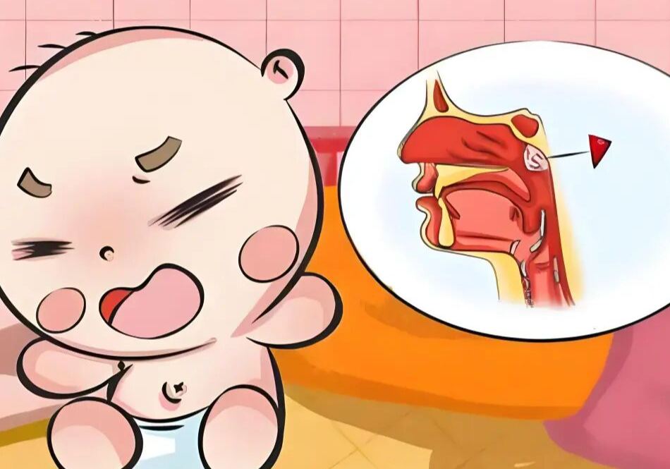 扁桃体、腺样体切or不切？