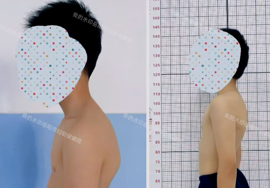 专注力提升、体态矫正、构音训练，这个寒假训练营我们都有