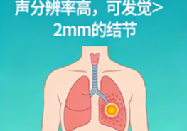 一文看懂：甲乳检查，为何超声是首选？