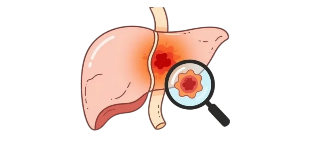 肝脏 (1)_副本0--.png