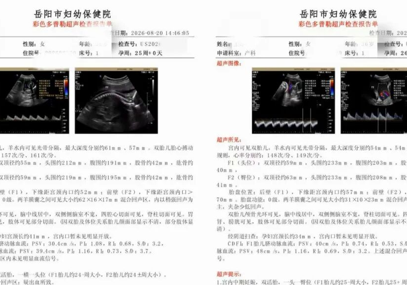 中西协同保胎  妙护高危双胎平安